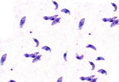 El parásito causante de la toxoplasmosis, visto bajo un microscopio.