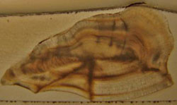 This otolith has two distinct "rings", meaning this fish is two years old.