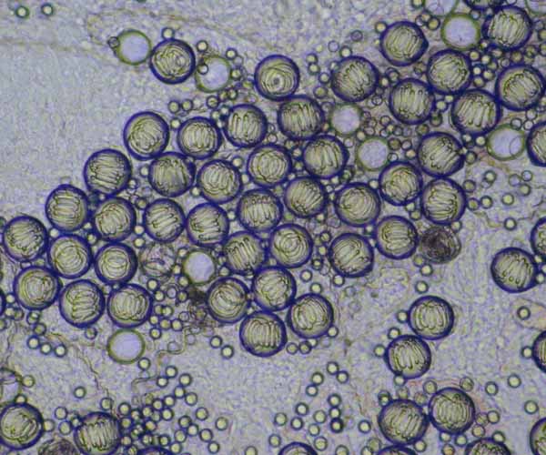 Nematocysts (stinging cells) of Portuguese Man o' War (Physalia physalis, 100x), coastal Charleston, SC 