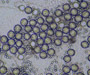 Nematocysts (stinging cells) of Portuguese Man o' War (Physalia physalis, 100x), coastal Charleston, SC Nematocysts (stinging cells) of Portuguese Man o' War (Physalia physalis, 100x), coastal Charleston, SC