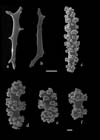 Diodogorgia nodulifera, cortical and medular sclerites