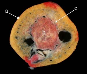 Diodogorgia nodulifera cross-section, showing cortex, medulla and boundary canals