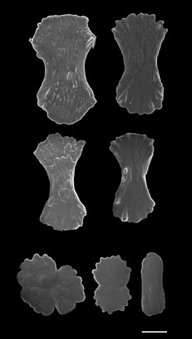 Sclerites of Sclerobelemnon theseus (S2312), from stalk.