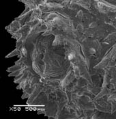 Figure 3. (top and bottom) Placogorgia sp., dried specimen (SERTC 2922), showing calyces and arrangement of thornscales and opercular rods. Scale bars = 500µm.