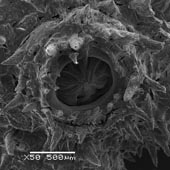 Figure 3. (top and bottom) Placogorgia sp., dried specimen (SERTC 2922), showing calyces and arrangement of thornscales and opercular rods. Scale bars = 500µm.